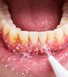 Before - Me sorprendió