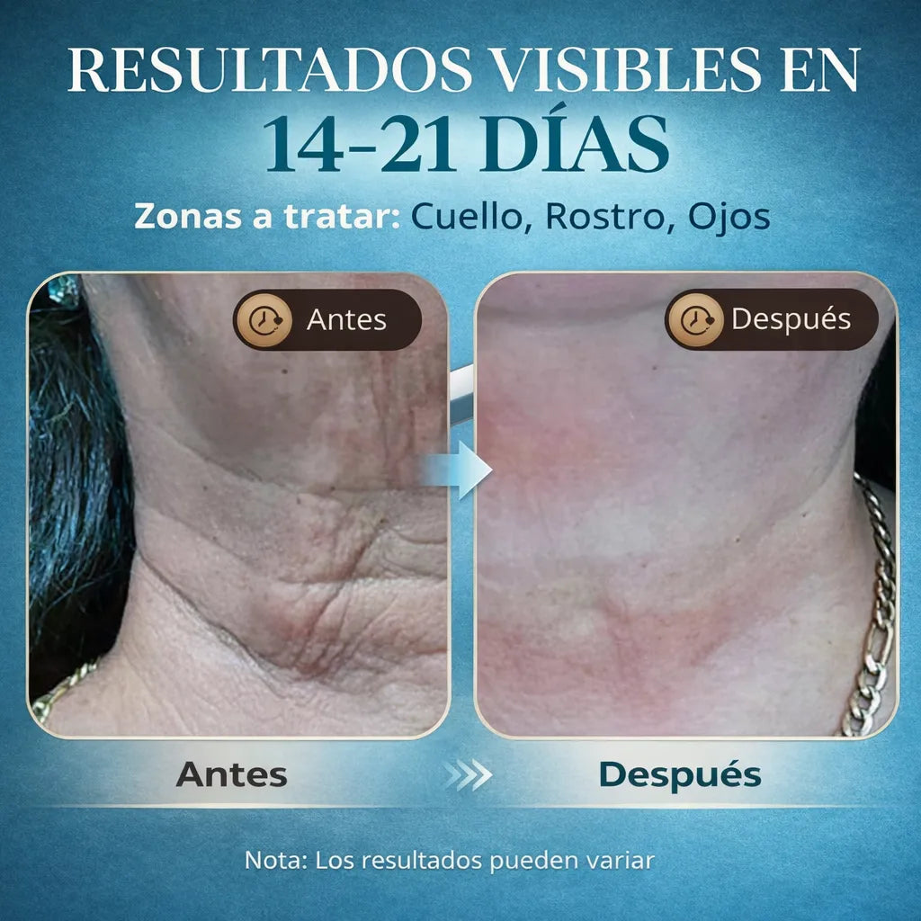 SculptLift Pro – Masajeador Facial Reafirmante
