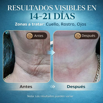 SculptLift Pro – Masajeador Facial Reafirmante