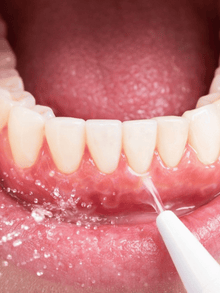 After - Me sorprendió