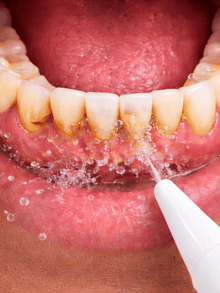 Before - Más cómodo de lo que pensé