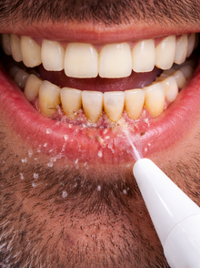 Before - Totalmente sorprendido